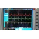 Digital Oscilloscope 200mhz 2ch +Battery+Bag Owon SDS8202V+B